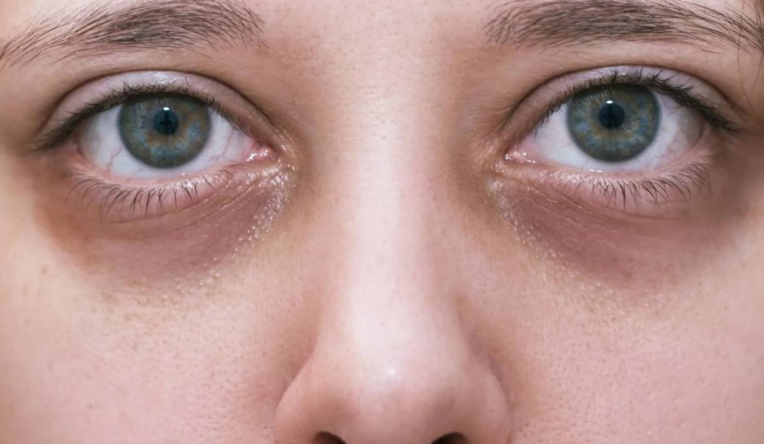 ilustrasi. Kesehatan mata. foto: Sukoharjo.news