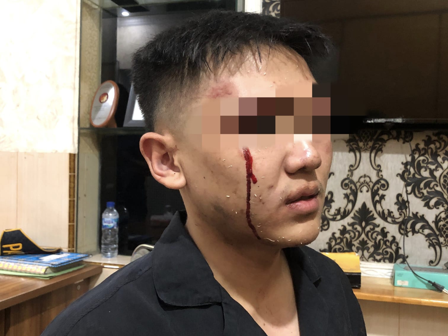 Korban yang mengalami luka saat membuat laporan ke Polres Binjai.