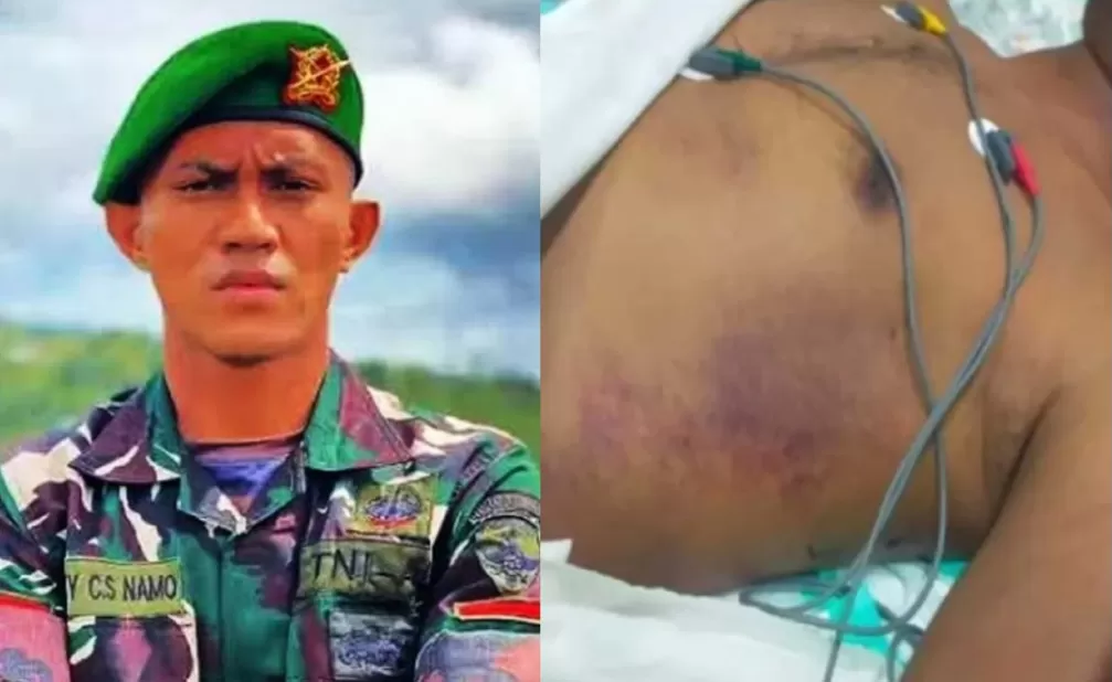 Prada Lucky Namo. (Dok: Lombok Post)