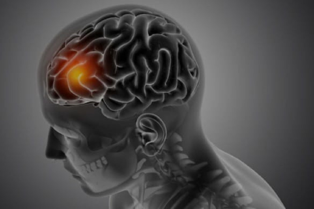 Ilustrasi, kesehatan otak juga sangat dipengaruhi makanan hingga tak gampang rusak. (freepik.com)