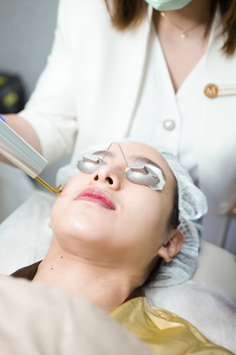 Miracle juga menghadirkan Miracle Pico Glow Toning, menggunakan energi laser picosecond dengan tembakan ultra cepat, untuk mengurangi akumulasi pigmen pada permukaan kulit. ( Miracle Aesthetic Clinic)
