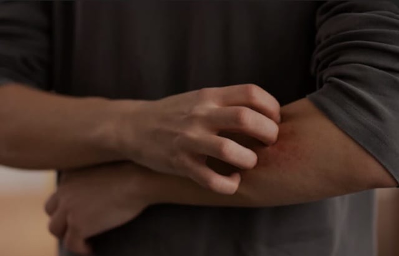 ilustrasi, rasa gatal pada tubuh tidak semata akibat penyakit kulit, tapi bisa juga karena diabetes. (freepik.com)