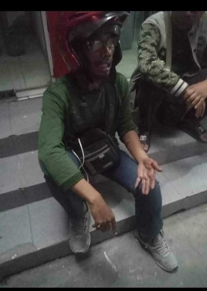 Dedi driver gojek korban begal mengalami luka bekas sabetan benda tajam yang di lakukan pelaku Begal di Lubukpakam. (BATARA/SUMUT POS)