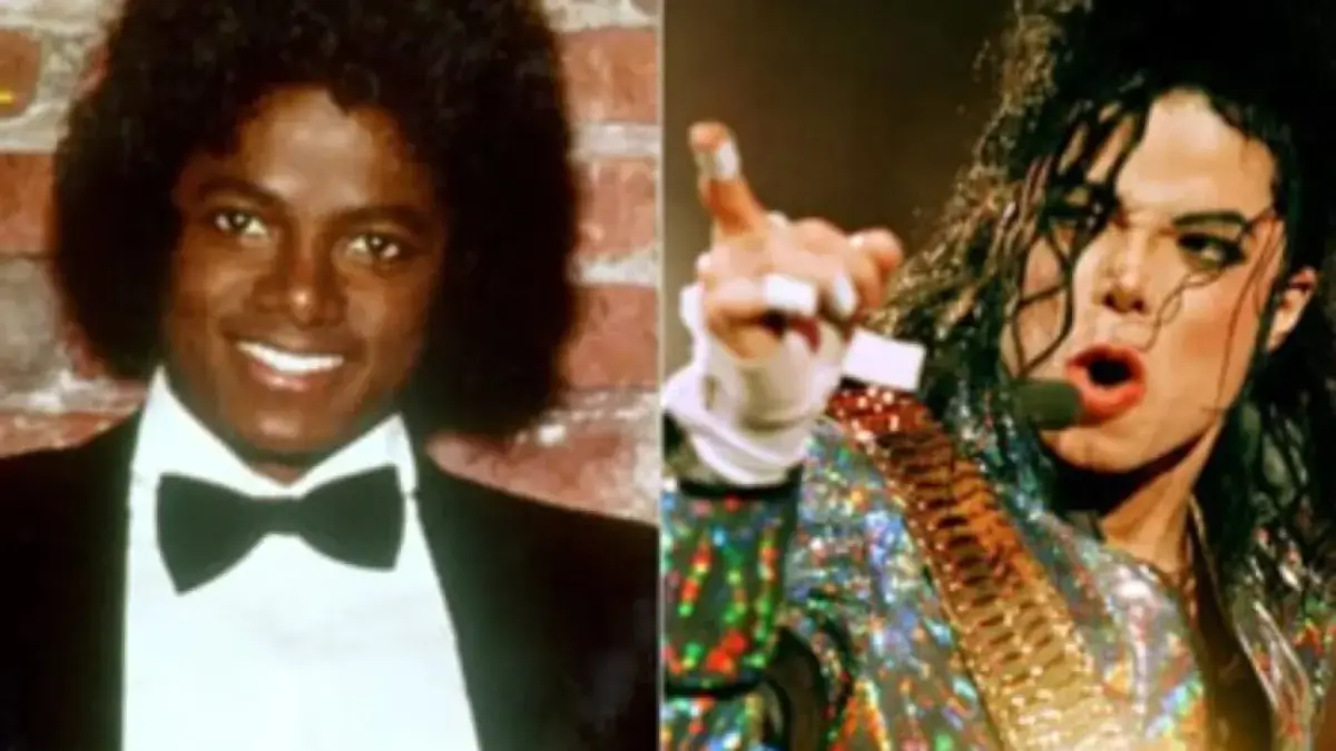 Michael Jackson Idap Vitiligo, Penyakit Kulit yang Bikin Warna Kulitnya Memutih