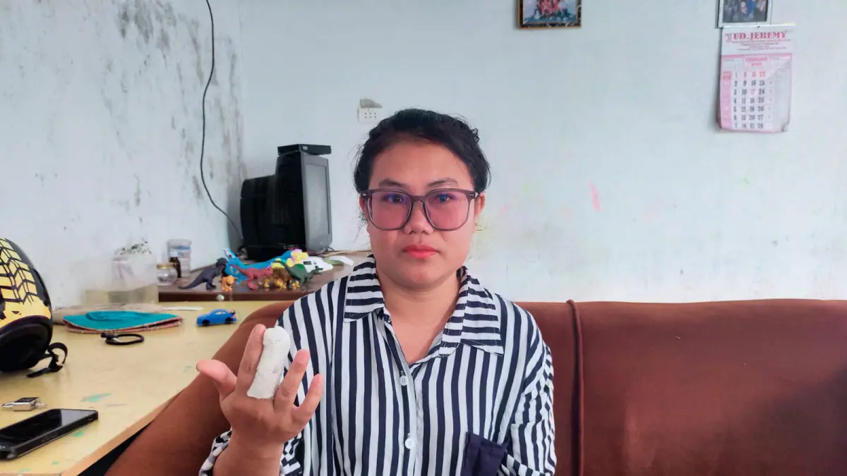 Konita Priska Saragih (35) korban dugaan tindak pidana penganiayaan menunjukkan salahsatu jari tanganya putus digigit tersangka kepada wartawan, Selasa (28/7/2026). (RUDY SITANGGANG/SUMUT POS.)