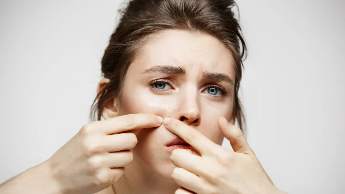 jangan asal pencet jerawat dihidung. (Freepik.com/Ilustrasi)