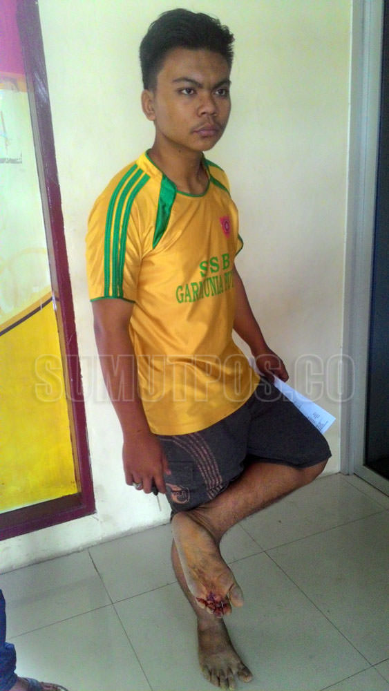 M Irfan duel melawan preman gara-gara tak syor ibunya dipandangi, hingga kakinya robek kena parang milik preman, Rabu (9/8) siang.