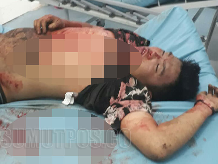 Foto: War/PM Bandar sabu Perbaungan, Lisan Jaya (23) warga Kelurahan Batang Terab, Kecamatan Perbaungan tewas dipelor.