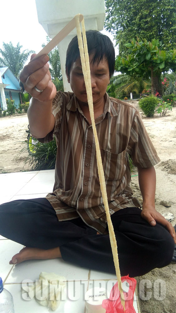 Foto: Istimewa Cacing pita sepanjang 2,8 meter yang ditemukan di perut seorang warga Simalungun, ditunjukkan seorang relawan penelitian.