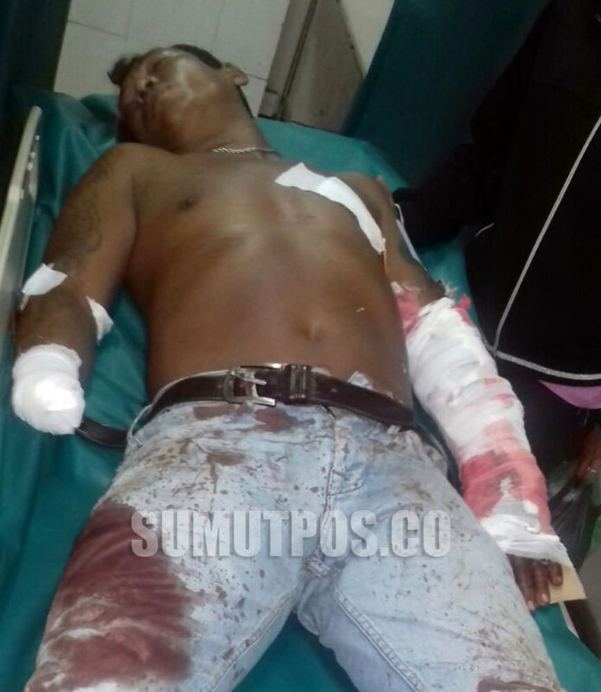 Foto: Sormin/PM Tangan penggarap bernama Purnamawanto, putus kena tebas kelewang, dalam bentrok antar dua kubu penggarap di Simpang Pasar 8 Desa Sampali, Percut Seituan, Selasa (10/10).