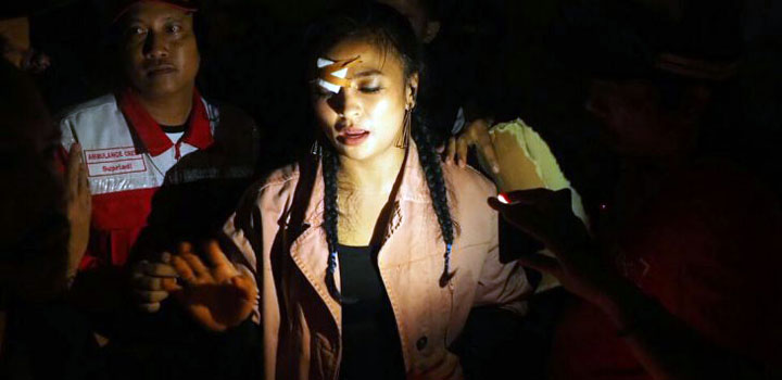 Tantri dengan pelipis diperban.