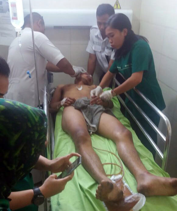 Pelaku belum sadarkan diri dan masih menjalani perawatan intensif di rumah sakit Bhayangkara Medan.