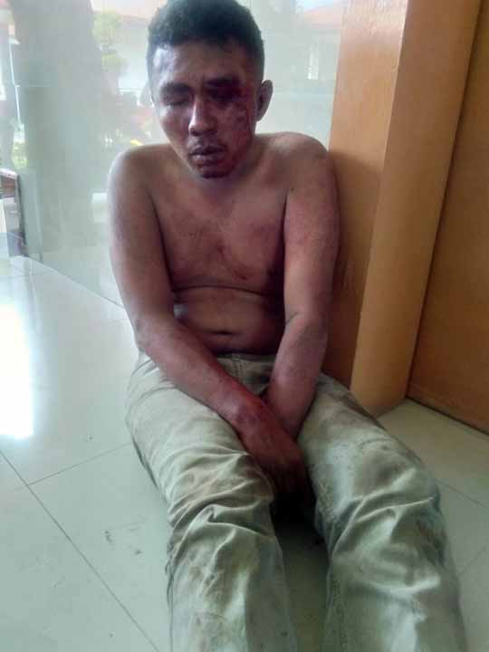 Imron Panjaitan babak belur dihajar warga.