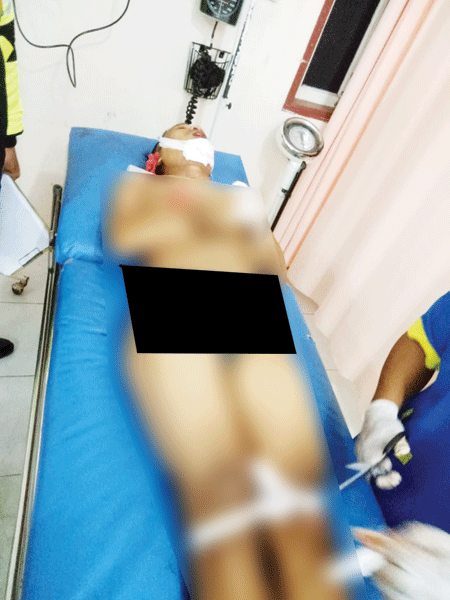 ISTIMEWA/SUMUT POS TEWAS: Joki balap liar, Benny Wijaya tewas usai menabrak bagian belakang dump truk, Minggu (5/8).