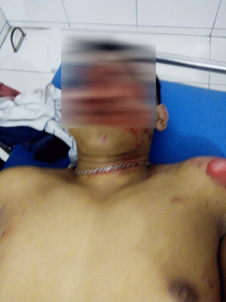 SOPIAN/SUMUT POS TEWAS: Khairul tewas mengenaskan usai menabrak trotoar menggunakan sepeda motor Yamaha Nmax.