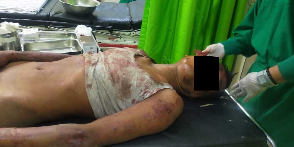 KRITIS: Terduga pelaku pencurian saat kritis dihajar massa dilarikan ke RSUD Djoelham Binjai.teddy akbari/sumut pos.