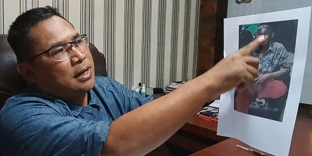 PAPARKAN: Kapolres Asahan, AKBP Putu Yudha Prawira SIK MH melalui Kasat Reskrim Polres Asahan, AKP Rahmadani SH MH menunjukkan foto korban yang mengalami luka yang cukup serius pada bagian wajah.