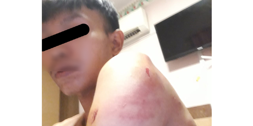 BINJAI: TKI asal Binjai berinisial Al (21) yang bekerja di Kamboja.