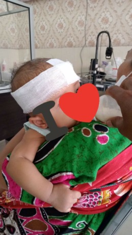 Korban yang terkena serang monyet liar.Istimewa.