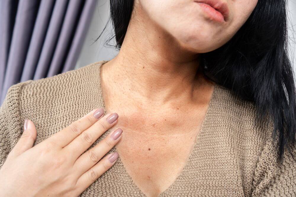 ILUSTRASI perempuan dengan kondisi Kulit kasar akibat gejala diabetes.