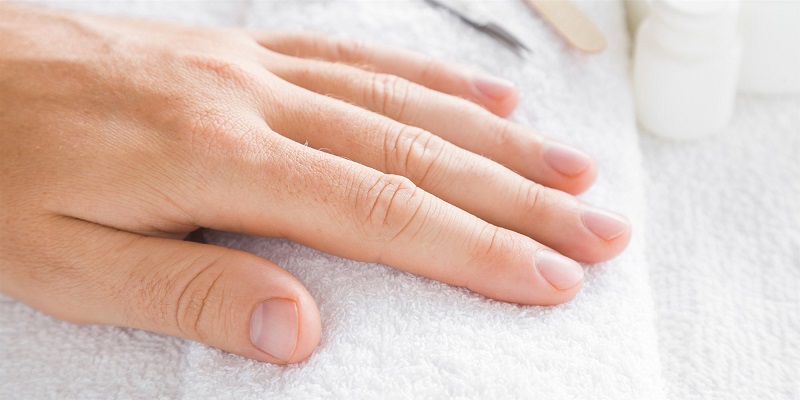 Ilustrasi. Kuku jari yang tumbuh melengkung bisa menjadi sinyal kondisi kesehatan yang patut diwaspadai.