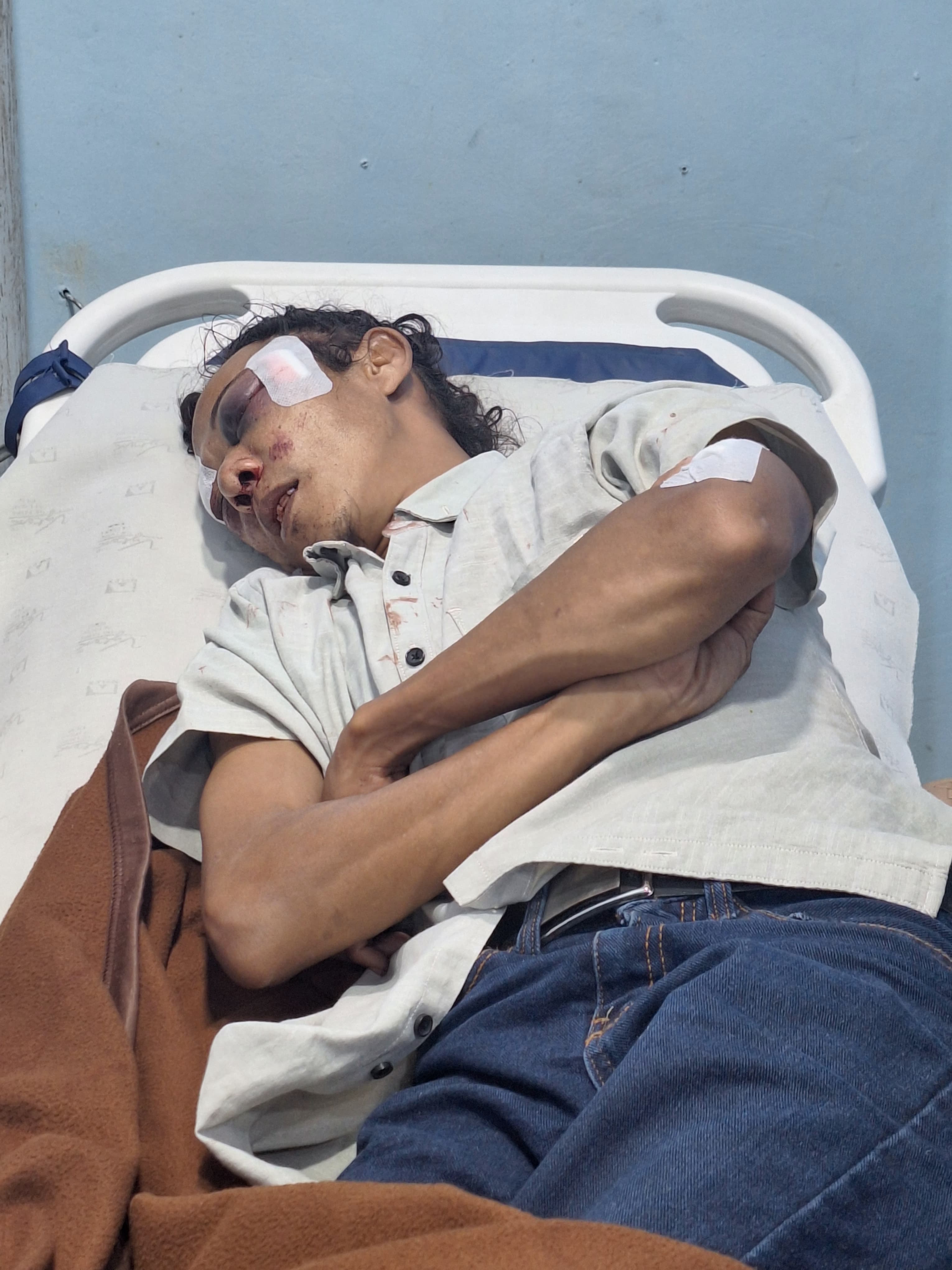 Salah satu korban penganiayaan.