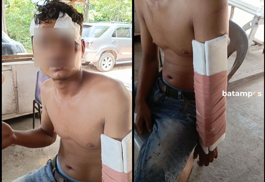 Bagus Harahap, korban penganiayaan di Batuaji.