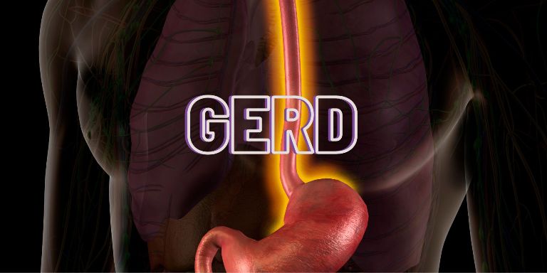 ILUSTRASI. Penderita asam lambung atau GERD tidak dianjurkan mengkonsumsi sayuran terong.