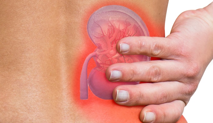 ILUSTRASI. Penderita ginjal kronis tidak dianjurkan mengkonsumsi ubi jalar yang mengandung kalium tinggi.