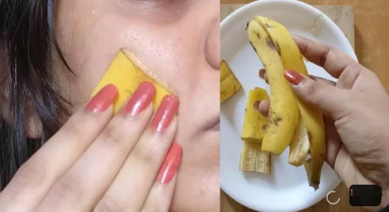 ILUSTRASI. Kulit pisang dapat diolah menjadi masker wajah alami.