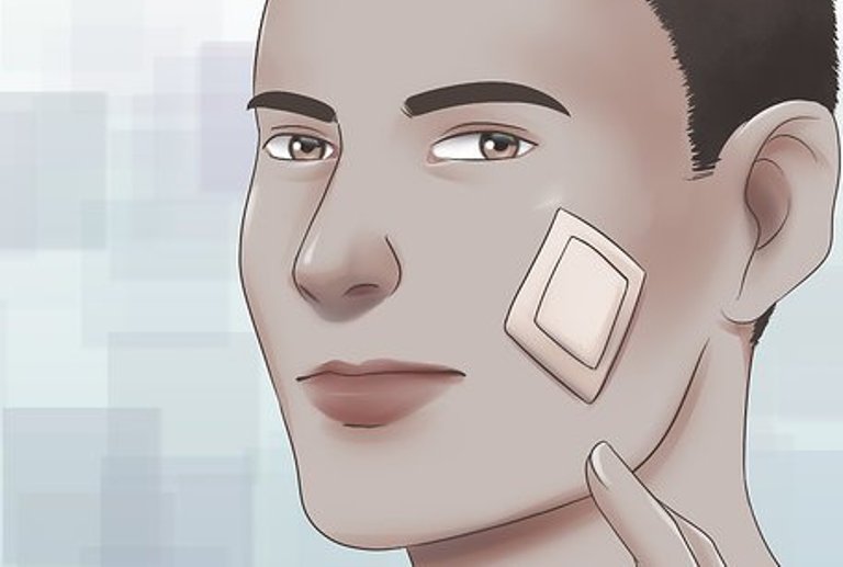 ILUSTRASI. Luka gores di wajah.