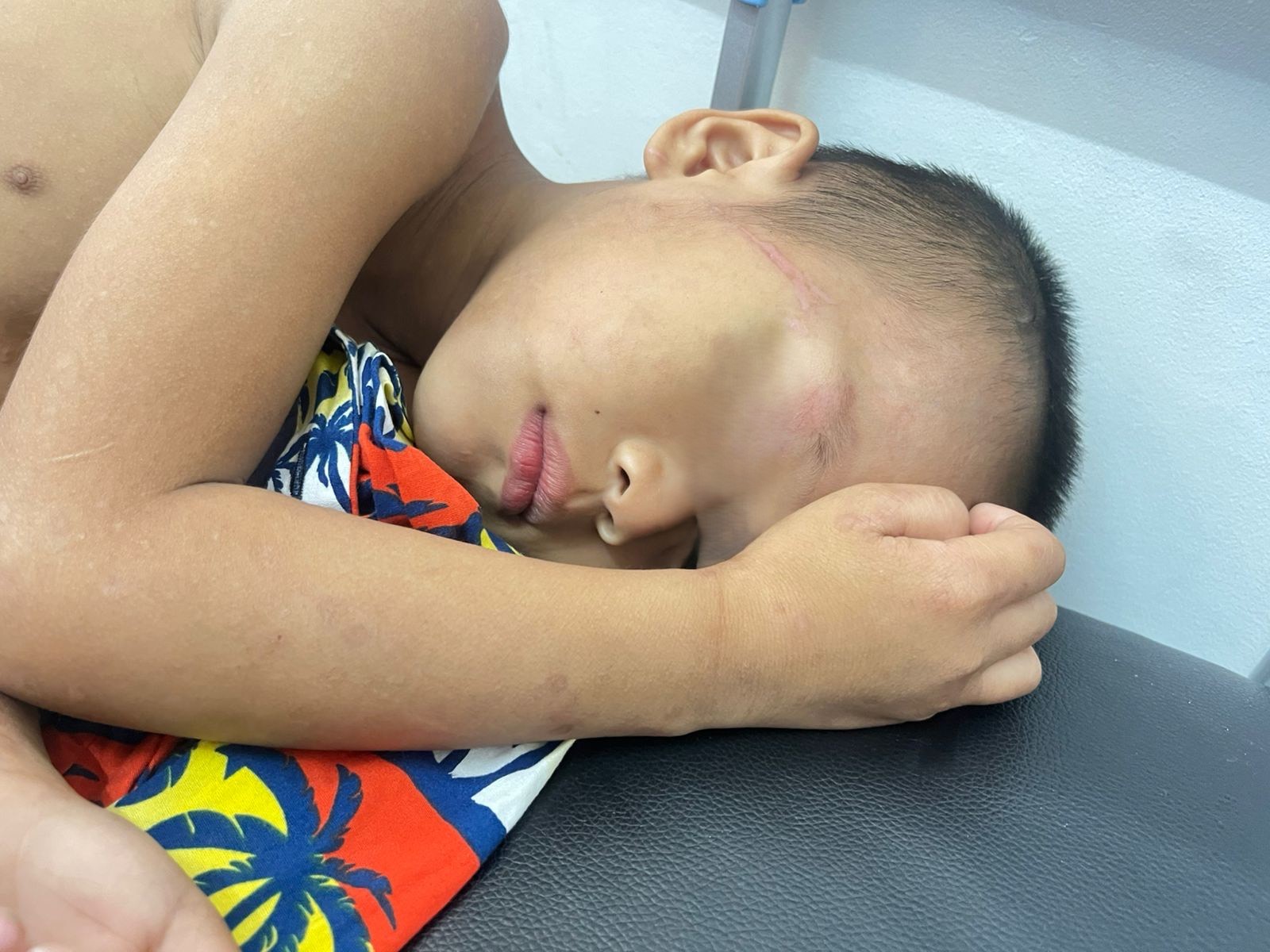 Korban terbaring lemah di Rumah Sakit Camantha Sahidiya, Mukakuning, Kota Batam.