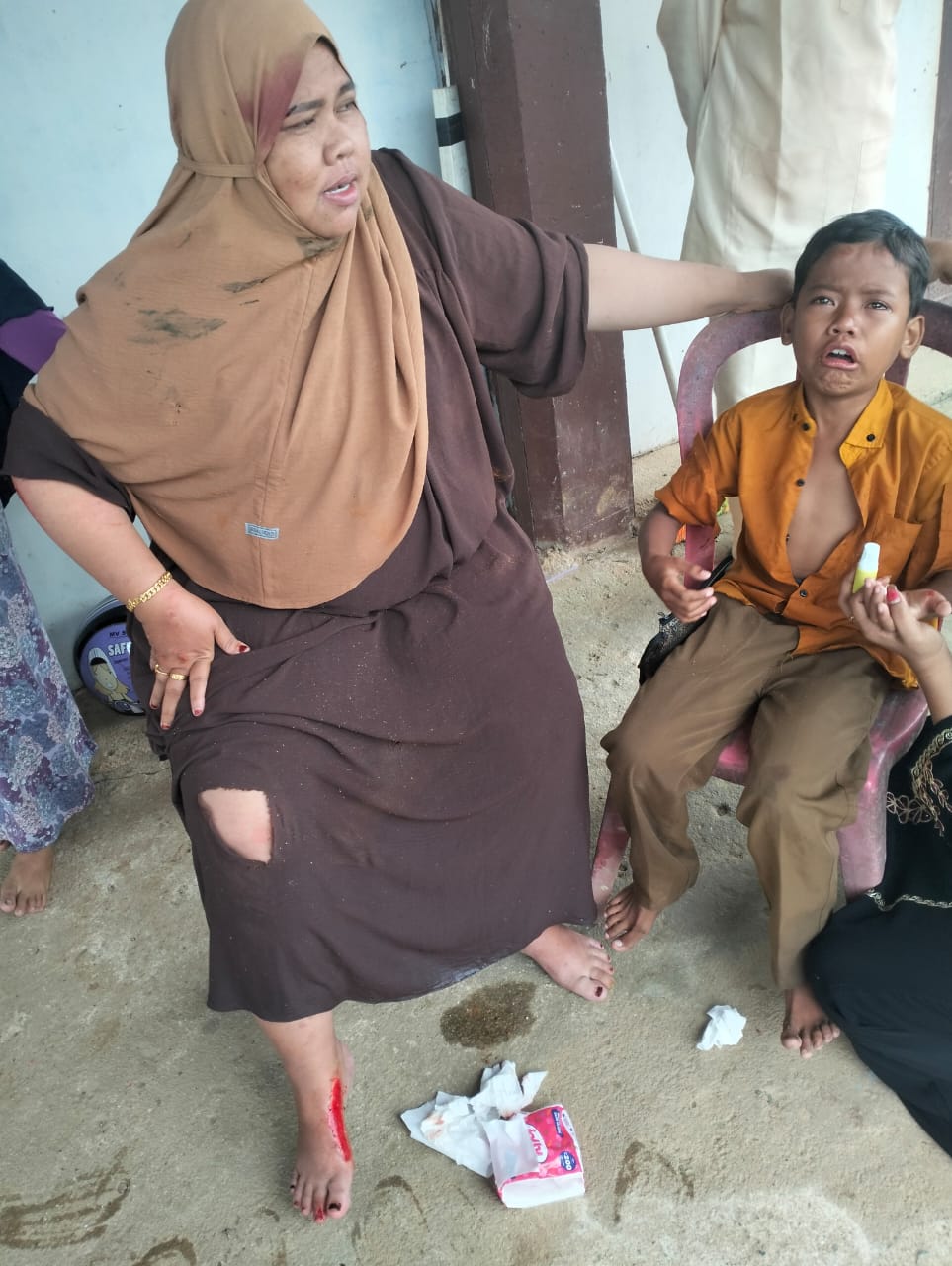 Korban, Kartika bersama anaknya, saat menjelaskan peristiwa kecelakaan yang disebabkan kabel yang diduga milik PLN.