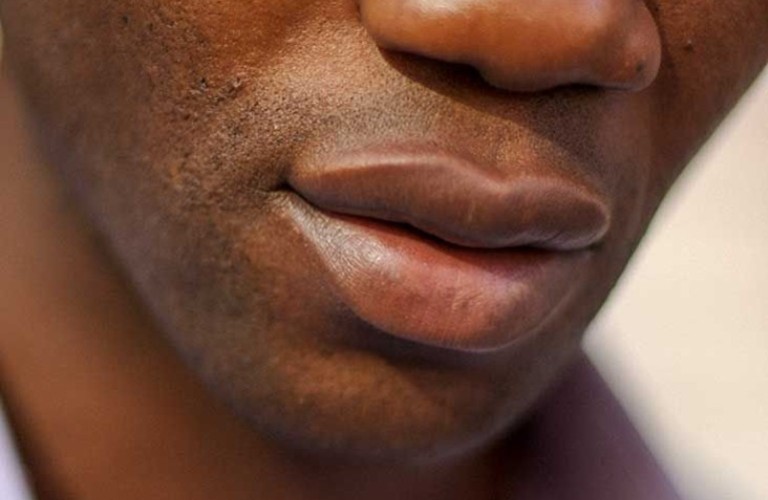 ILUSTRASI. Bibir pria dapat menunjukkan karakter yang tersembunyi.