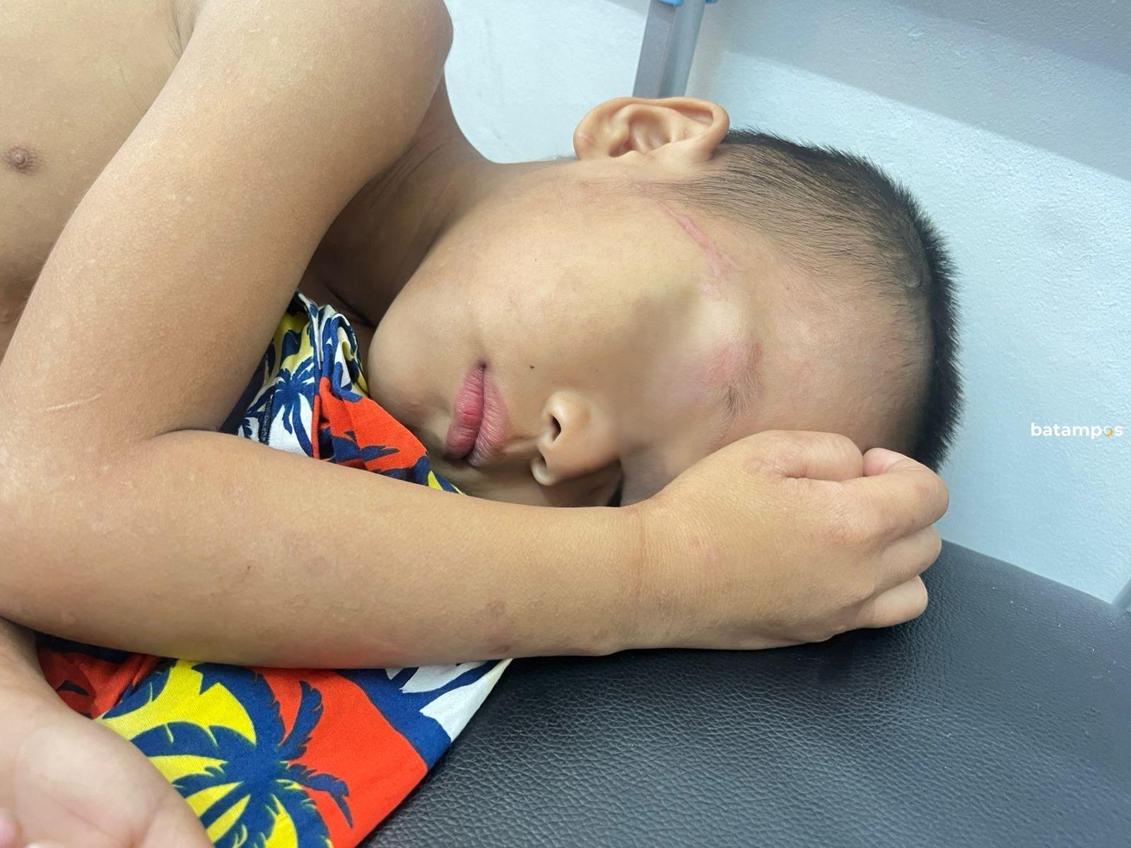 Korban penganiayaan saat terbaring lemah di Rumah Sakit Camantha Sahidiya, Mukakuning, Kota Batam.