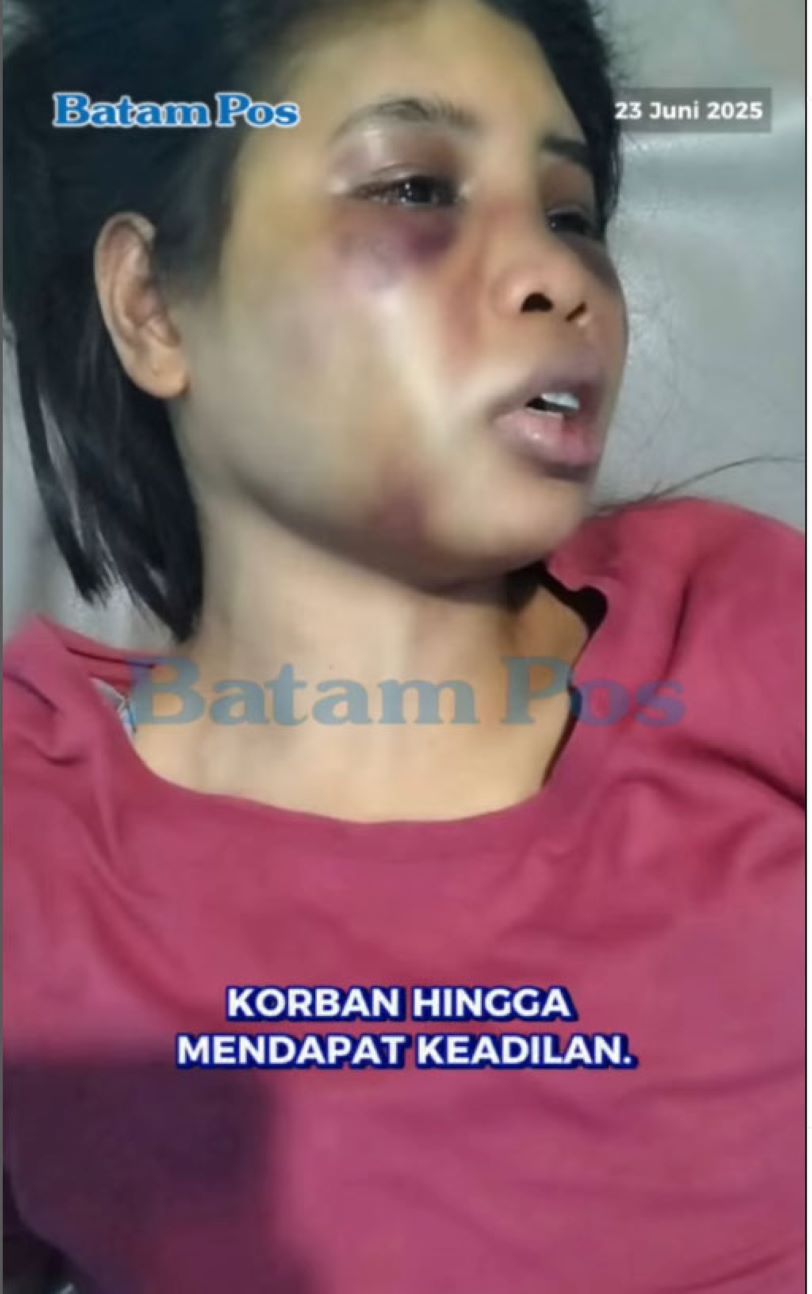 ART korban penganiayaan oleh majikan di rumah elit Sukajadi Batam.