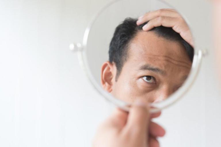 ILUSTRASI. Seorang pria mengecek perubahan pada rambut kala memasuki usia 40 tahun.