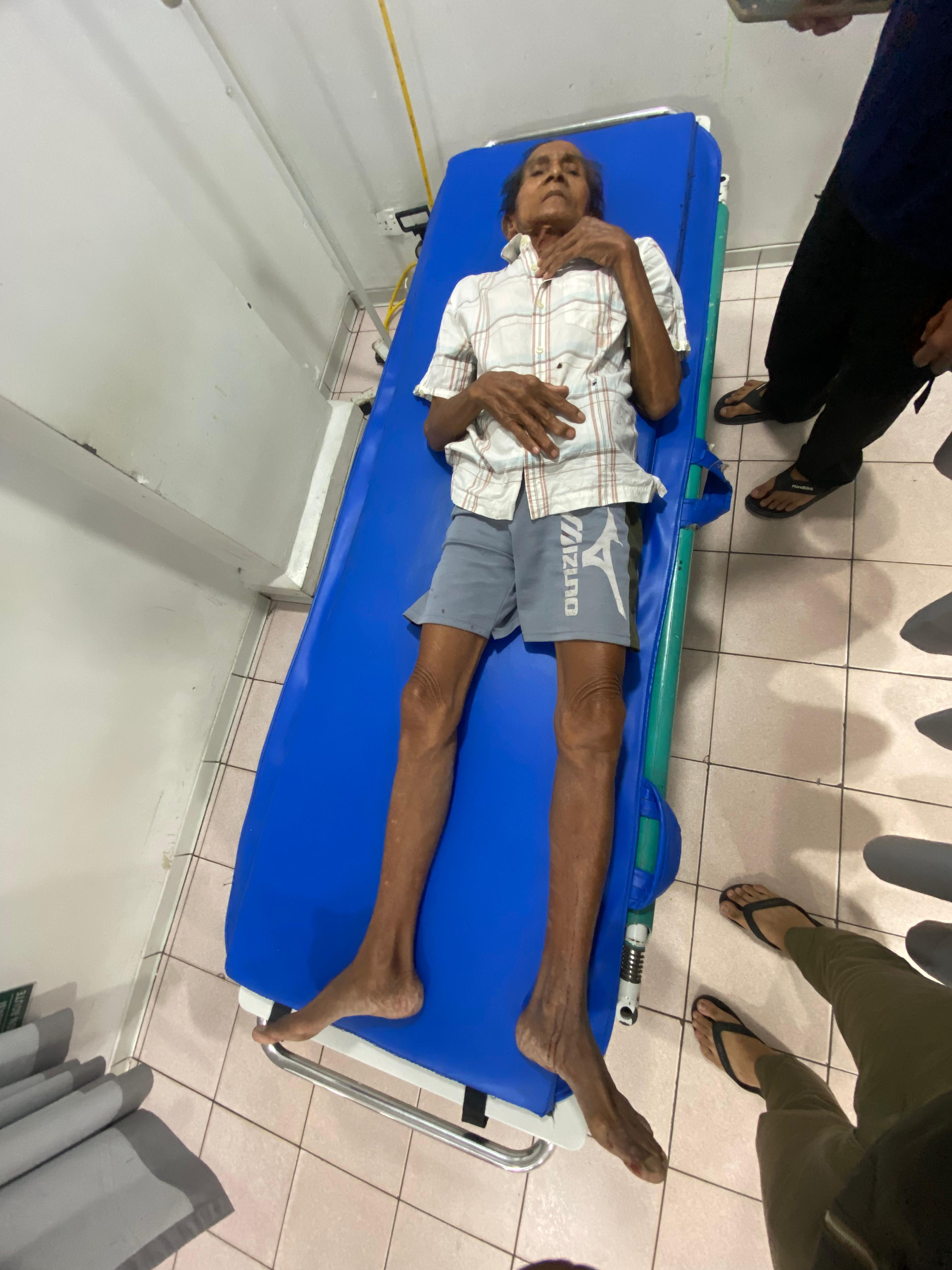 Korban penikaman obeng di kepala berinisial MD saat dibnawa ke rumah sakit.