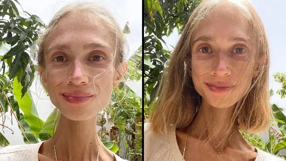 Karolina Krzyzak (27) asal Polandia meninggal di Bali karena diet buah ekstrem