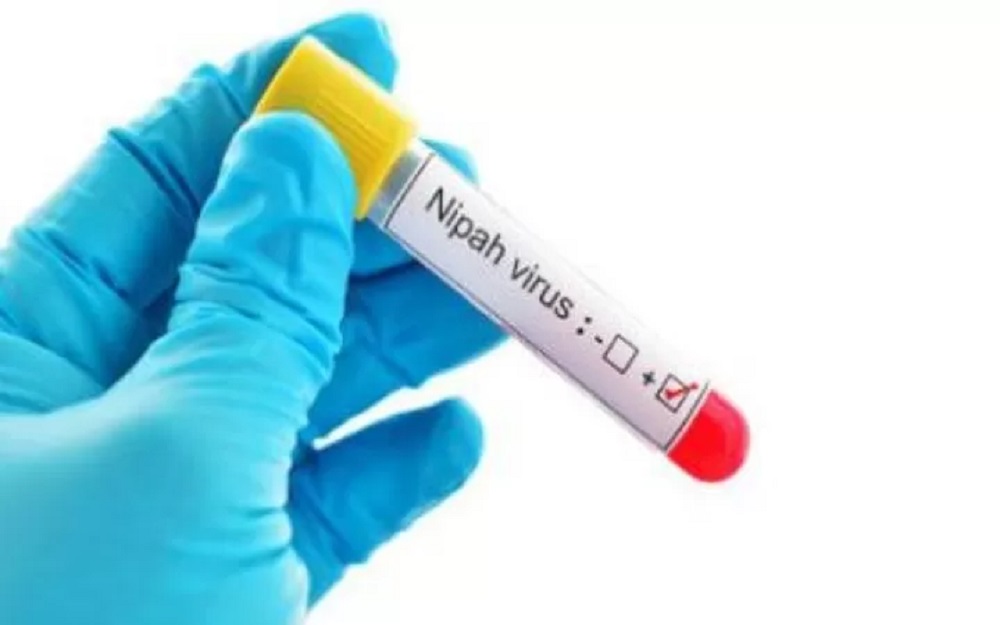 Virus Nipah, penyakit zoonosis mematikan yang ditularkan dari kelelawar ke manusia dan memiliki tingkat kematian hingga 91 persen. (PINTEREST)