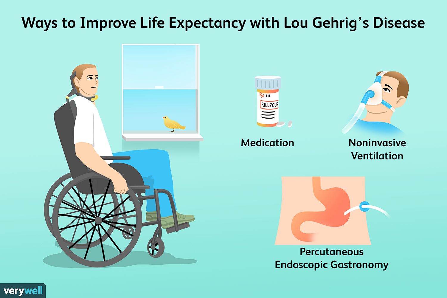 ILUSTRASI penyakit Lou Gehrig dan cara penanganan untuk meringankannya. F Verywell Health
