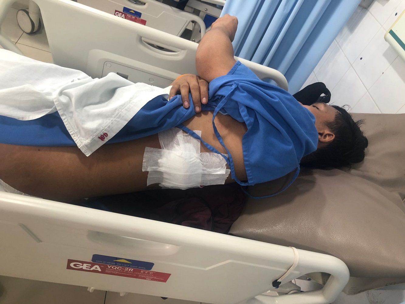 Korban bernama Agus Suwandi, 26, mengalami luka tusuk akibat serangan menggunakan senjata tajam jenis karambit. F. Eusebius Sara/Batam Pos