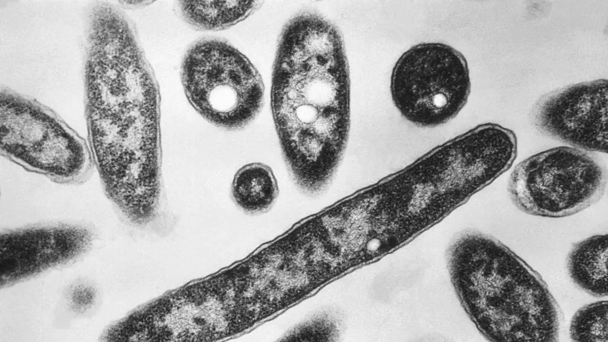 New York terkena wabah legionnaires. (x.com/MOSSADil)