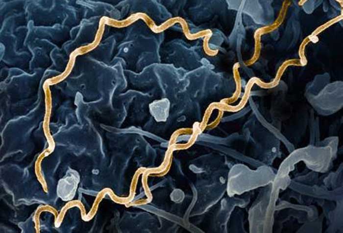 BAKTERI: Penampakan bakteri triponema, penyebab sifilis ketika diperbesar dengan mikroskop.