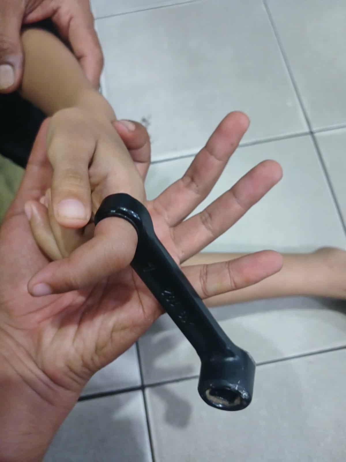 : Tim rescue Damkar Kota Palangka Raya saat melakukan penanganan. Insert jari Habibi saat masih terpasang pedal sepeda Listrik.