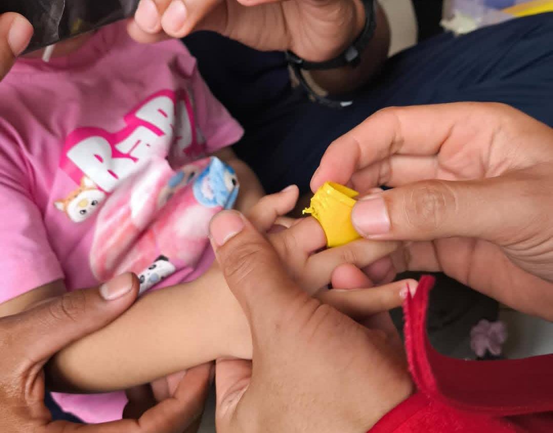 Petugas Disdamkarmat Kotim memotong tutup botol yang menjepit jari bocah perempuan di Sampit dengan alat pemotong, hingga akhirnya bocah itu bisa bernapas lega lagi.