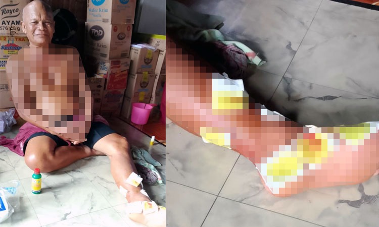 Itai, 65 tahun, warga Desa Camba, Kecamatan Kota Besi, Kabupaten Kotawaringin Timur, yang jadi korban serangan buaya.