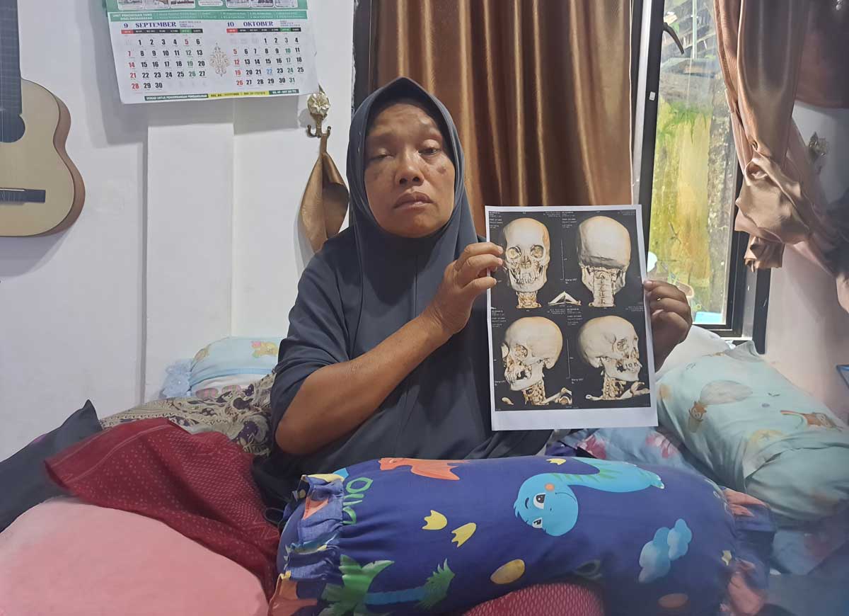 DIRAWAT: Sri Rohani, Ketua Yayasan Panti Asuhan Annida Qolbu menunjukkan hasil rontgen keretakan tulang pipi dan rahang akibat pemukulan, Jumat (14/11).