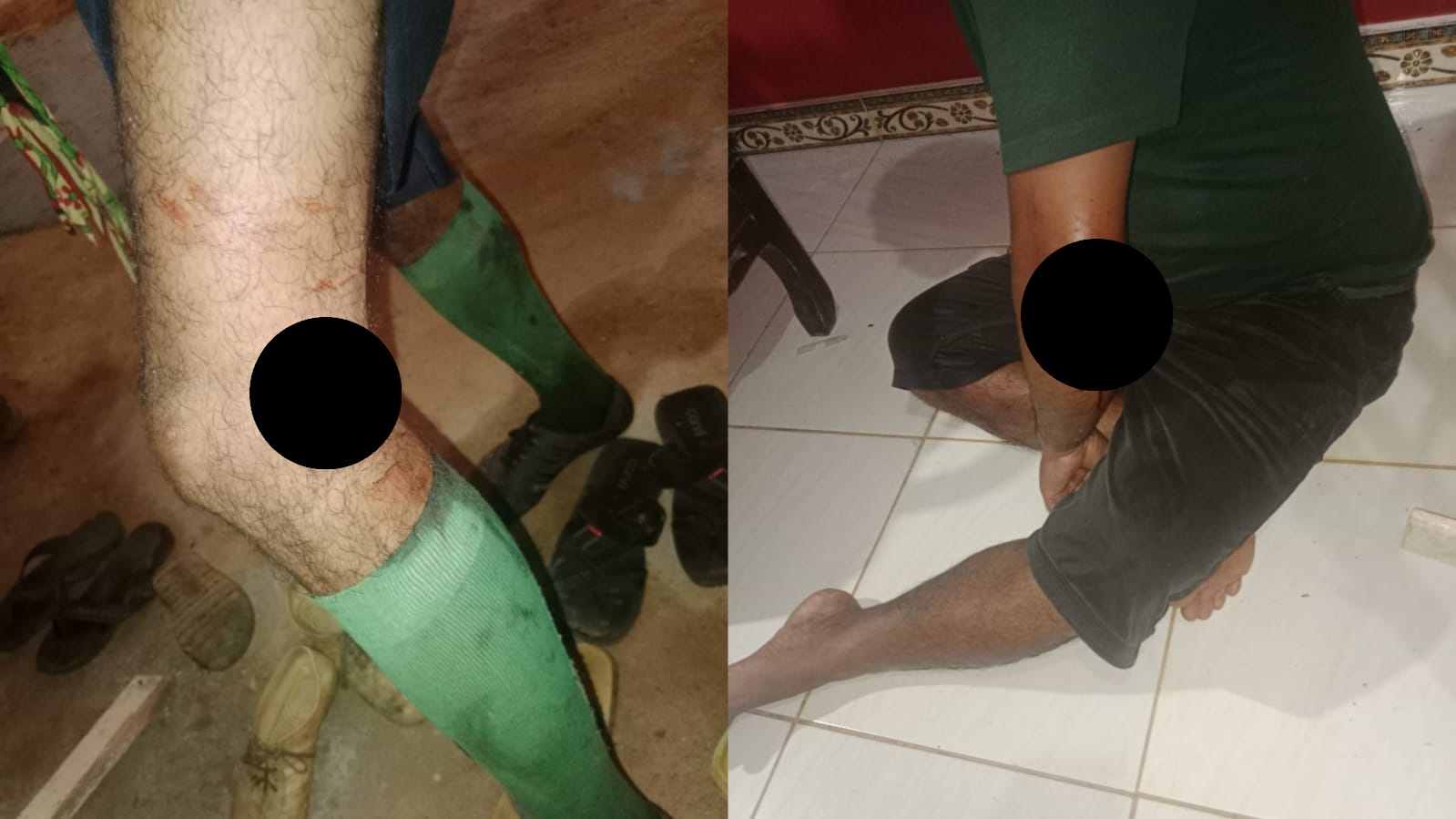 TERLUKA: Dua warga yang terluka diduga karena ditembak aparat keamanan (warga/radar sampit)