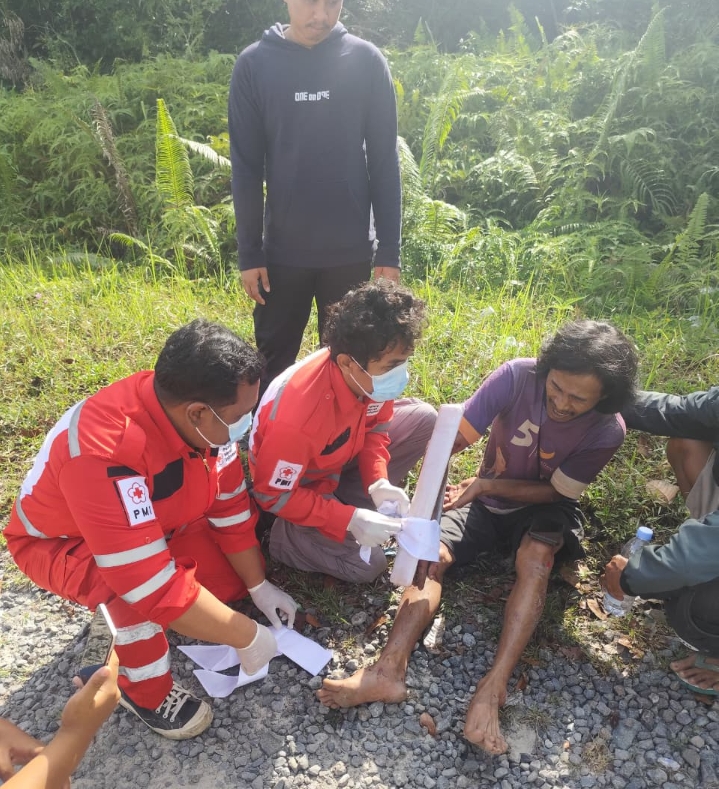 Pengendara Vixion mengalami patah kaki usai kecelakaan di Jalan Ahmad Yani kilometer 12 Pangkalan Bun, Minggu (8/2).